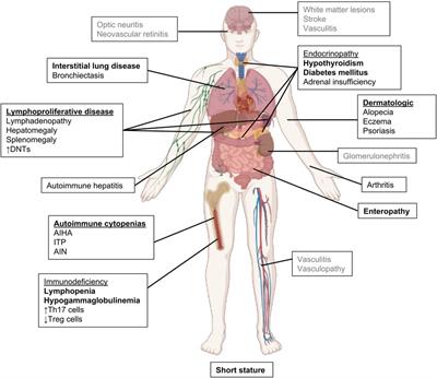 STAT3 gain-of-function syndrome